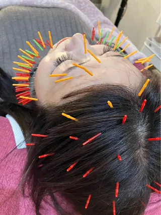 美容鍼灸女性専用 りんご鍼灸治療院のその他イメージ