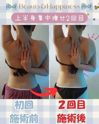 痩身ハーブピーリング 筋膜リリース☆B&Hのエステ・リラクイメージ