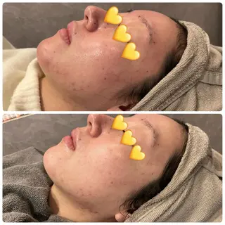 yellow.所属・yellow💛【 脱毛&フェイシャル】のエステ・リラクイメージ