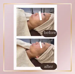 Belle Ami所属・Belle Amiのエステ・リラクイメージ