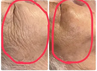 ナリス化粧品De I’mあべのルシアス所属・山本 紗織のエステ・リラクイメージ