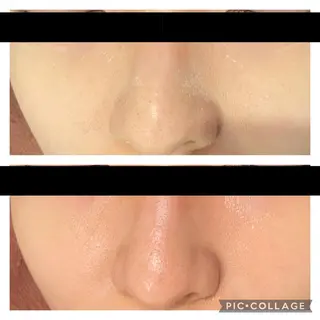 セミロング カラー パーマ ヘアアレンジ メンズ キッズ ネイル マツエク・マツパ アイブロウ ニキビ特化型エステ 🍓最短で肌質改善のエステ・リラクイメージ