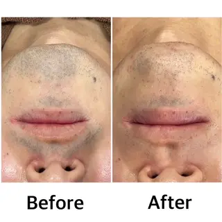 林 陽向のエステ・リラクイメージ