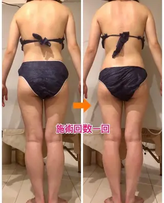 ロング カラー パーマ ヘアアレンジ メンズ ネイル マツエク・マツパ ‍痩身＆ボディ 結果出し🌟丹野のエステ・リラクイメージ