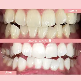 セルフホワイトニング エクシア札幌琴似店のその他イメージ