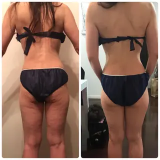 調律エステ /美KISSのその他イメージ