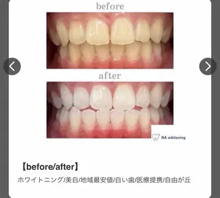 エミルカ　自由が丘店所属・ニキビ改善ハーブ🌿 ハナシマのその他イメージ