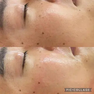 メンズ RE:moom リムーム/脱毛エステのエステ・リラクイメージ