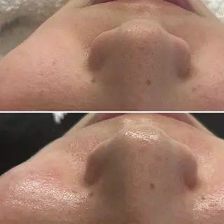 韓国🇰🇷価格 サロン_Nbibiのエステ・リラクイメージ