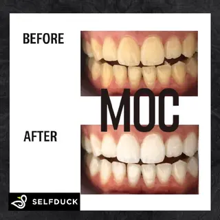 歯科提携セルフダック 宇都宮駒生店のエステ・リラクイメージ