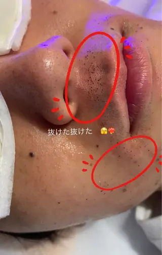 メンズ I'iris所属・【脱毛サロン iiris】占い可のエステ・リラクイメージ