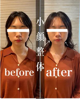 鍼灸整骨院Refine所属・鍼灸 Refineのその他イメージ