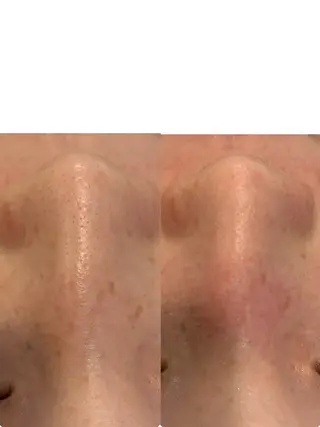 Fulala 永田のエステ・リラクイメージ