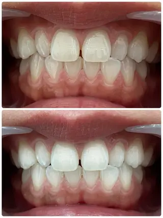 ホワイトニングサロン Clear所属・ホワイトニングサロン Clearのエステ・リラクイメージ