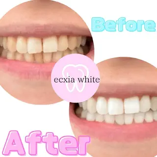 エクシアホワイト奥田店所属・エクシアホワイト 奥田店のその他イメージ