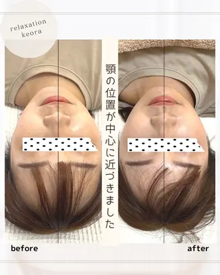 小顔矯正& 慢性肩こり腰痛改善店のエステ・リラクイメージ