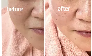 シミ・たるみ・毛穴ケア専門サロン Alluring所属・Alluring 中村のエステ・リラクイメージ