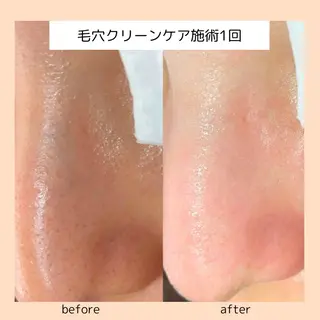 【three】毛穴/ 肌改善/小顔/耳ツボのエステ・リラクイメージ