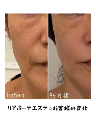 浜野 恵美のエステ・リラクイメージ