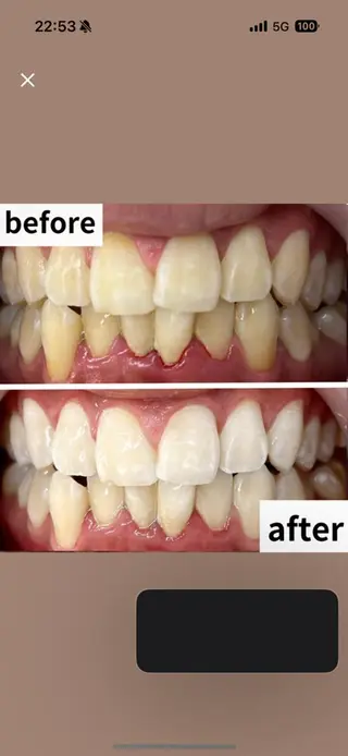 LBSホワイトニング 🌐渋谷店 小河原のエステ・リラクイメージ