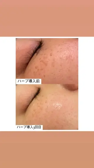 トータルビューティ サロンstageのエステ・リラクイメージ