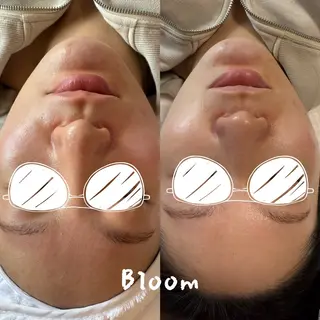 Bloom所属・ネイル＆フェイシャル Bloomのエステ・リラクイメージ