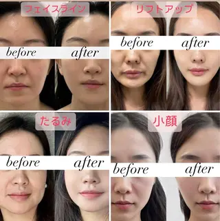 マツエク・マツパ aliaハイフ&水光ジェットサロン所属・aliaハーブ水光店 エステティシャン募集のエステ・リラクイメージ