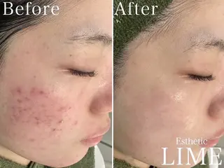 Belle栄店所属・韓国肌管理 Belle栄店のエステ・リラクイメージ