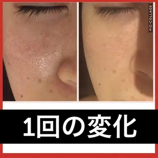 ミディアム パーマ ヘアアレンジ メンズ キッズ ネイル マツエク・マツパ ニキビ・肌質改善専門 ♡人生が変わるサロンのエステ・リラクイメージ