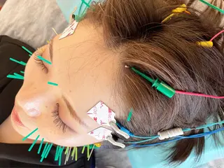 小顔美容鍼専門サロン 渋谷YZのエステ・リラクイメージ