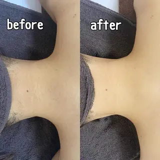 都度払い制脱毛サロンBe Charm所属・Be Charm 山﨑のエステ・リラクイメージ