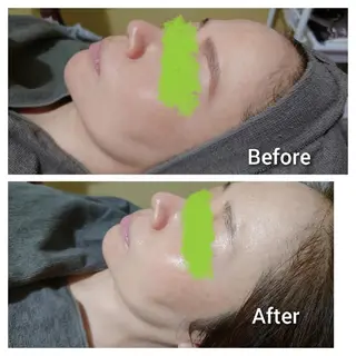 Beauty Salon Luana所属・Luanaまつパ脱毛 ハーブピーリング眉毛のマツエク・マツパデザイン