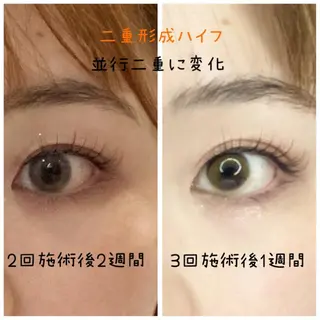 第一印象専門サロン ADISEのエステ・リラクイメージ