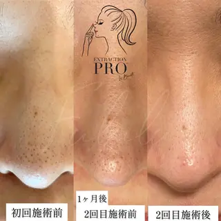 毛穴専門サロン　フルール所属・フルールFululu 自由が丘のエステ・リラクイメージ