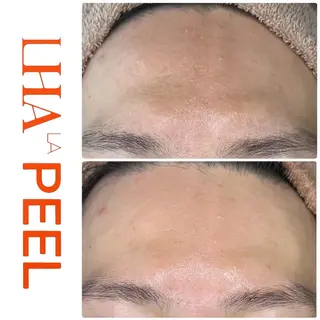 ハーブピーリング専門 BIOEL横浜のエステ・リラクイメージ