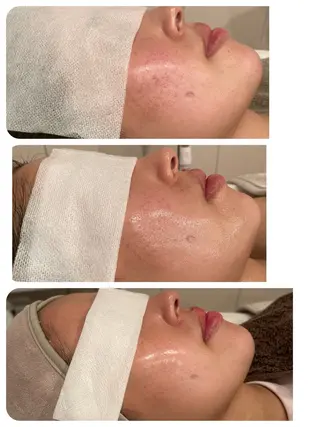 小顔×肌質改善サロン soin〔ソワン〕のエステ・リラクイメージ