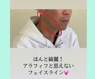 小顔と ヘッドスパのお店のエステ・リラクイメージ