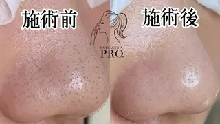 Lipula リプラ所属・毛穴ツヤ肌専門    Lipulaのエステ・リラクイメージ