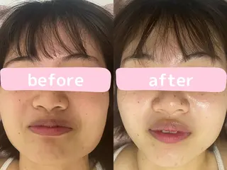 看護師が施術する 美容サロン/元治のエステ・リラクイメージ