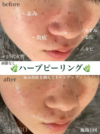 e-LABO こいずみのエステ・リラクイメージ