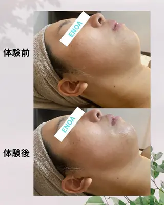 ENOA所属・コルギ/全身リンパ saoriのエステ・リラクイメージ