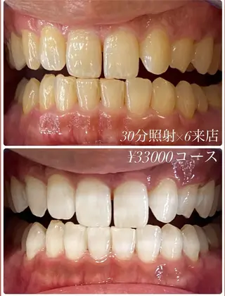 ホワイトニングルーム　川崎店所属・ホワイトニング ルーム　川崎店のその他イメージ