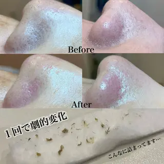 Wita   aesthetic×eyelash所属・上坂 祐以のエステ・リラクイメージ