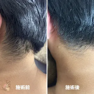 メンズ salon Removeのエステ・リラクイメージ