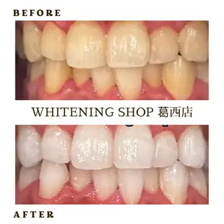 メンズ ホワイトニング ショップ葛西店のその他イメージ