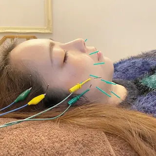 美容鍼　蒼月-aotsuki-所属・美容鍼「蒼月」 -アオツキ-のエステ・リラクイメージ