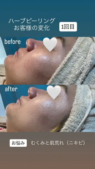 HALU _HARUのエステ・リラクイメージ