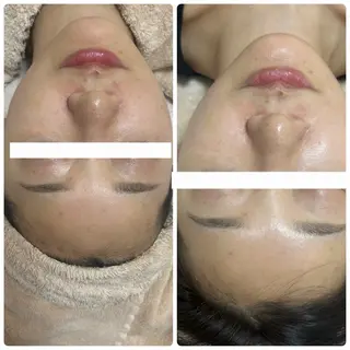 脱毛専門減毛サロン LULU.tokyoのエステ・リラクイメージ