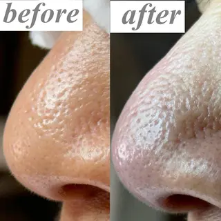 毛穴専門サロン ライカブルーのエステ・リラクイメージ