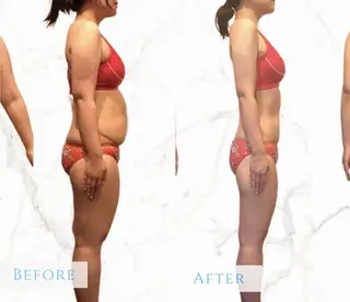 レセラ銀座所属・レセラ 銀座のエステ・リラクイメージ